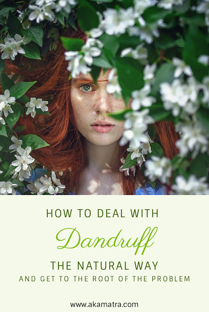 How to deal with dandruff the natural way and get to the root of the problem